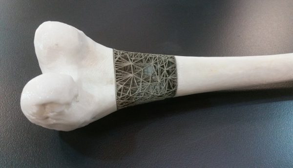 RMIT3D Printed Bone